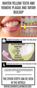 Communicate with your dentist regularly. Pin On Lotions Potions And Slimes