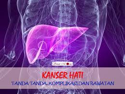 Tanda Tanda Kanser Hati Yang Ramai Tak Tahu