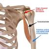 Flex and medially rotate the shoulder joint. 1