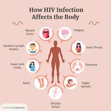 Image result for HIV Exposure