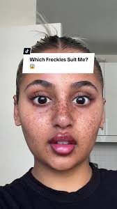 Who Looks The Best with Freckles