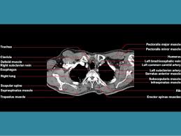 Related posts of muscles shoulder and back muscle anatomy lower extremity. Anatomy Of Chest