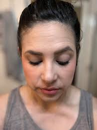 Help please (again) : r/30PlusSkinCare