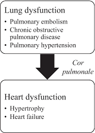 Image result for Cor Pulmonale