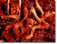 April 17, 2016 at 6:41 pm. Pictures Of Aborted Babies Wisconsin Right To Life