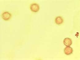 Image result for Nuxia oppositifolia