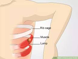 How To Check Lymph Nodes Lymph Nodes Swollen Lymph Nodes Armpit Lymph Nodes Armpit