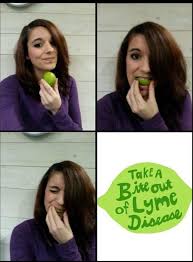 C'est aussi le cas en amérique du nord, en europe. Le Temoignage D Une Jeune Bisontine Atteinte De La Maladie De Lyme Macommune Info