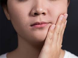 The condition typically affects children between the ages of 2 to 7 until puberty. Cherubism Causes Symptoms And More