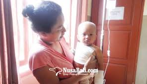 Kulit melecur terkena air panas di rumah? Nusabali Com Dua Balita Terkena Air Panas