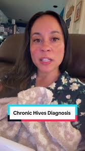 Recap of my chronic hives diagnosis! Sharing for anyone else strugglin...