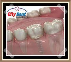 مخطئ من يعتقد أن مجال زراعة الاسنان الفورية وربما مجال زراعة الأسنان قد ظهر زراعة الأسنان الفورية فجأة على ساحة طب الأسنان dental clinic dental clinic