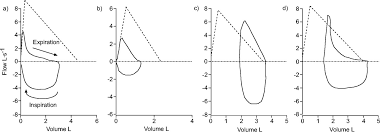 Interpretative Strategies For Lung Function Tests European