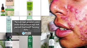 Latest videos most viewed videos longest videos random videos. 10 Produk Terbaik Mampu Milik Untuk Kulit Orang Malaysia Yang Ada Masalah Jerawat Pernah Beli Produk Untuk Muka Berjerawat Tapi The Body Shop Skin Care Acne