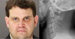 Christopher duntsch, nicknamed dr death, is a former neurosurgeon in jail for gross medical the texas doctor was responsible for injuring 33 out of 38 patients within a span of fewer than two. Dr Death The Texas Surgeon Who Paralyzed His Patients