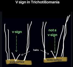 Image result for Trichoscypha silveirana