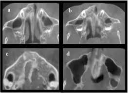 Image result for Usm 22159