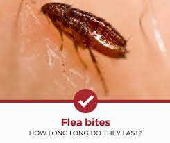 How to stop fleas from biting me. How Long Do Flea Bites Last A Simple Guide Pest Strategies