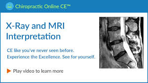 Nothing creative you will say! X Ray And Mri Video Chiropractic Online Ce Com