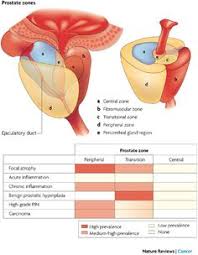 11 Ideas De Prostata Ultrasonido Cancer De Prostata Imagenes De Ultrasonido