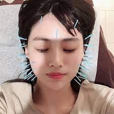 美容鍼 噛む筋肉がものすごく硬い方は鍼を打った時に顎の筋肉がぴくっと動く事があります これは一瞬びっくりしますが 鍼の反応なので問題ありません むしろ筋肉が緩むのでとても良い反応です 食いしばりがひどい方は美容鍼で改善していきましょう 美容鍼 鍼