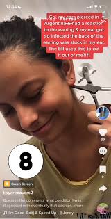 Kaya shared her chronic illness tells before her dx : r/illnessfakers