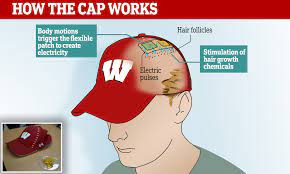 Hair growth stems at the most base level from a healthy blood supply deep in the hair follicles, which wearing a hat has no effect on. Hat That Zaps The Scalp With Electricity Helps Reverse Male Balding Scientists Say Daily Mail Online