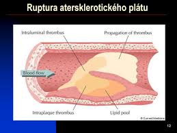 Արցախյան պատերազմի եւ մեր ժամանակի հերոսները (ֆոտոռեպորտաժ). Dr Tudor Mihaita