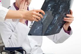 Hasil gambar untuk Pengobatan Syaraf Terjepit Tanpa Operasi