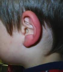 Image result for Ear Nerve Block