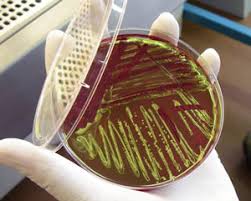 Behandlungen für schleim im stuhl. Gesundheit Ehec Enterohamorrhagische Escherichia Coli Bakterien