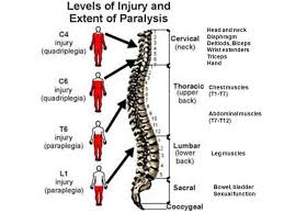 Belajar tentang struktur tulang belakang anda dapat membantu anda memahami masalah tulang belakang. Apm Tumpat Topik Kecederaan Tulang Spinal Tulang Facebook