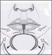 1 watcher737 page views11 deviations. Lower Lip Reconstruction With Local Neuromusculocutaneous Advancement Flap Journal Of Plastic Reconstructive Aesthetic Surgery