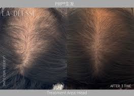 When your skin is in SOS mode, #StellarM22 has the answer  The newest  generation of IPL technology with multi-wavelengths + 9 filters for fully  customized treatments.  Targets pigmentation, redness, uneven