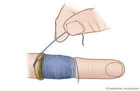 Removing A Ring From A Finger Or Toe Life Hacks Hacks Good To Know
