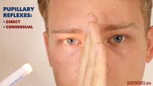 A Step By Step Approach To Cranial Nerve Examination In An Osce Setting With An Included Video Demonstration Cranial Nerves Nerve Medical