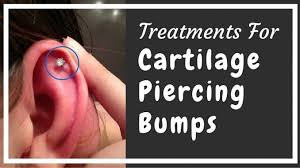 How To Get Rid Of Cartilage Piercing Bumps Professional Piercing Kits Piercing Bump Cartilage Piercing Ear Piercing Care