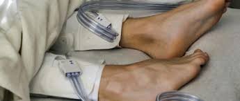 We did not find results for: The Warning Signs Of Deep Vein Thrombosis Nursing In Practicenursing In Practice