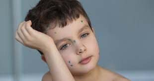 Dr. Robert Allen Beekman MD, Pediatrician in Ellsworth, ME, 04605