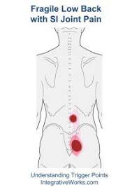 Pin On Trigger Points