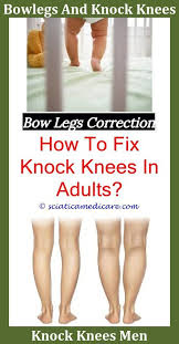 Bow Legged Baby What Does Bow Tattoos On Back Of Legs Mean Bow Leg Surgery Recovery Time Bow Legged Man Is Bow Leg Knock Knees Bow Legged Bow Legged Correction