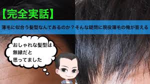 薄毛に悩む女性にはショートヘアがおすすめな理由髪型画像あり