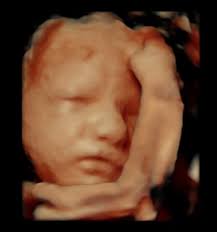 As the baby grows, the amount of amniotic fluid will be reduced. 30 Week Ultrasound Reveal 3d 4d Ultrasound Studio