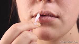 Herpes Hausmittel Alternativen Zu Medikamenten Netdoktor