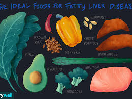 Fatty Liver Disease What To Eat For Better Management