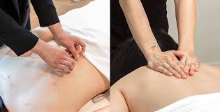 Image result for Acupuncture