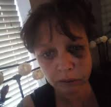 Victim of horrific domestic violence says daughter is 'the angel who saved  my life' as she shares shocking pictures of injuries