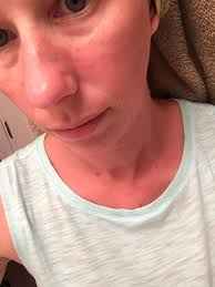 Anything i can use for my face it only breaks out