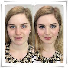 Before & After Archives