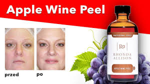 Apple Wine Peel 30 ml pH 0.8